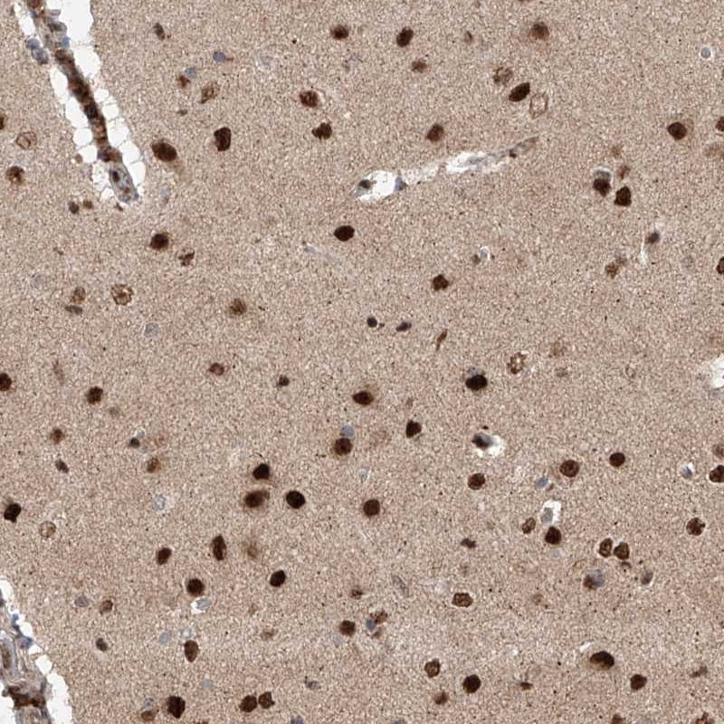 ZNF280D Antibody - BSA Free Immunohistochemistry-Paraffin: ZNF280D Antibody [NBP1-82207]