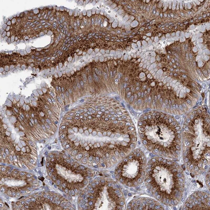 QPCTL Antibody - BSA Free Immunohistochemistry-Paraffin: QPCTL Antibody [NBP1-82208]