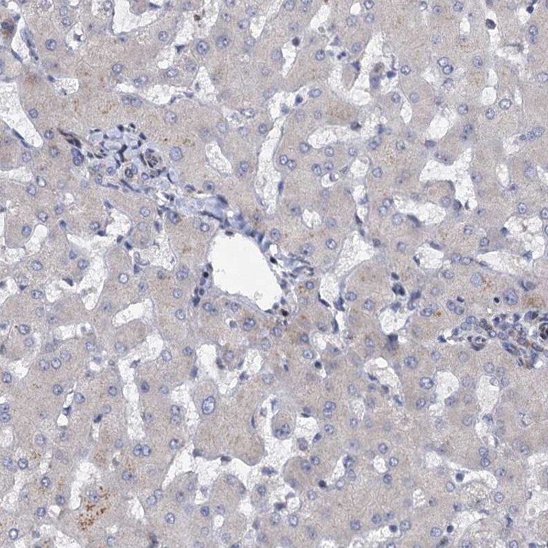 QPCTL Antibody - BSA Free Immunohistochemistry-Paraffin: QPCTL Antibody [NBP1-82208]