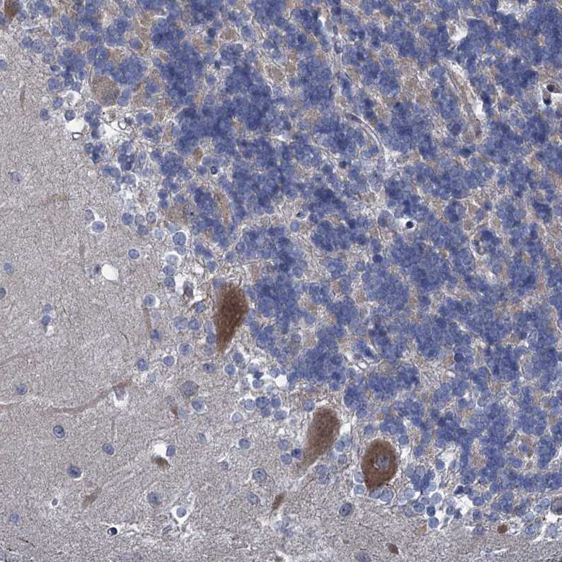 QPCTL Antibody - BSA Free Immunohistochemistry-Paraffin: QPCTL Antibody [NBP1-82208]