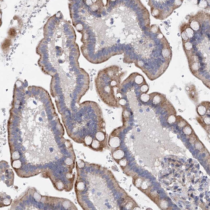 QPCTL Antibody - BSA Free Immunohistochemistry-Paraffin: QPCTL Antibody [NBP1-82208]