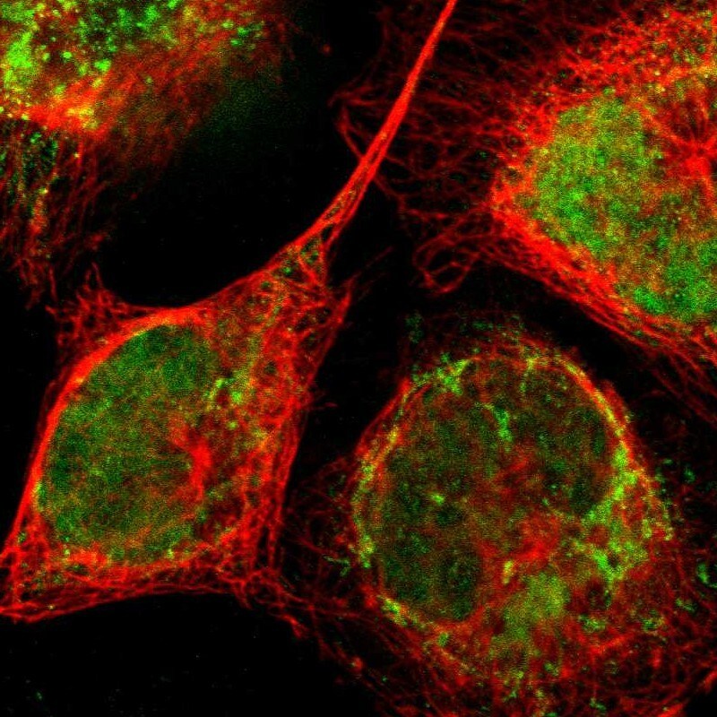 ZNF782 Antibody - BSA Free Immunocytochemistry/ Immunofluorescence: ZNF782 Antibody [NBP1-82211]