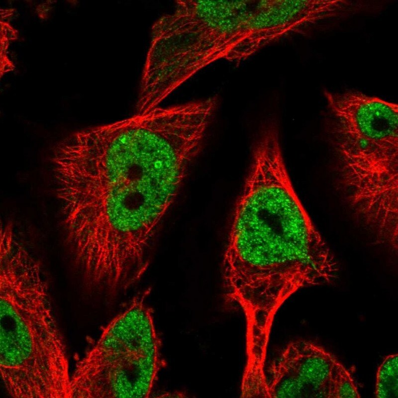HDAC6 Antibody - BSA Free Immunocytochemistry/ Immunofluorescence: HDAC6 Antibody [NBP1-82212]