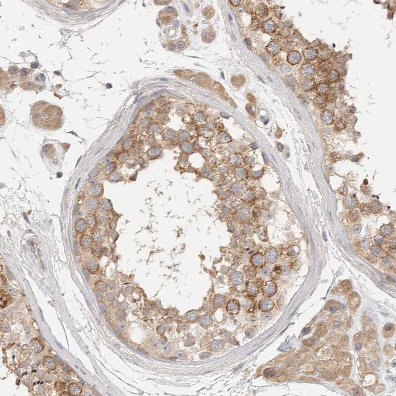 HDAC6 Antibody - BSA Free Immunohistochemistry: HDAC6 Antibody - BSA Free [NBP1-82213]