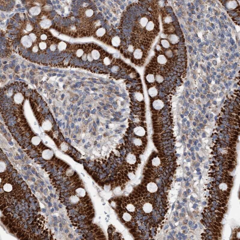 ZNF566 Antibody - BSA Free Immunohistochemistry-Paraffin: ZNF566 Antibody [NBP1-82222]