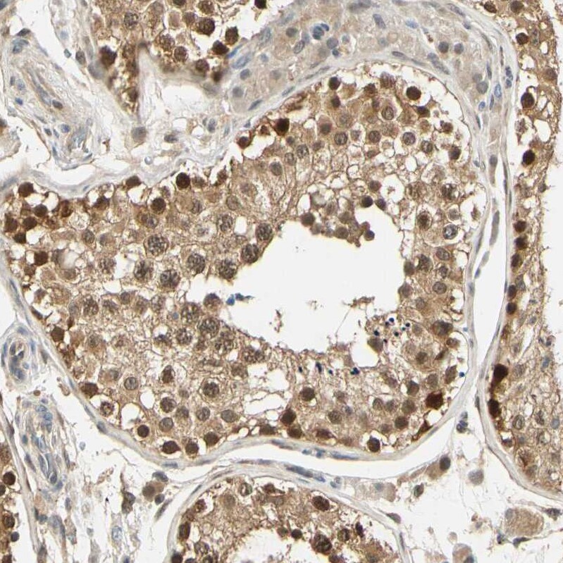 UBE2Z Antibody - BSA Free Immunohistochemistry-Paraffin: UBE2Z Antibody [NBP1-82245]