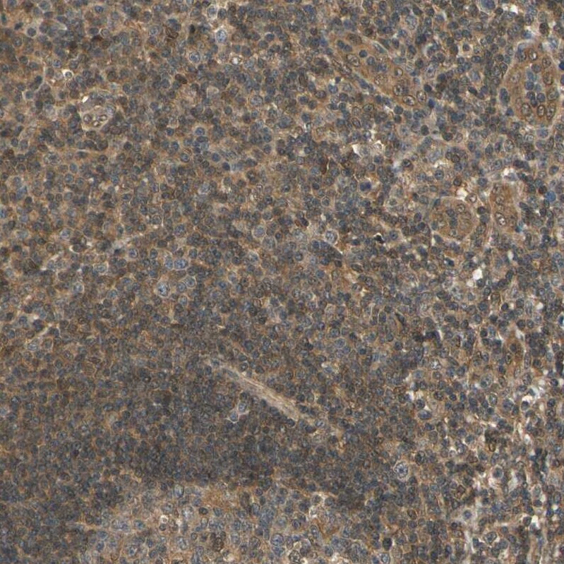UBE2Z Antibody - BSA Free Immunohistochemistry-Paraffin: UBE2Z Antibody [NBP1-82245]