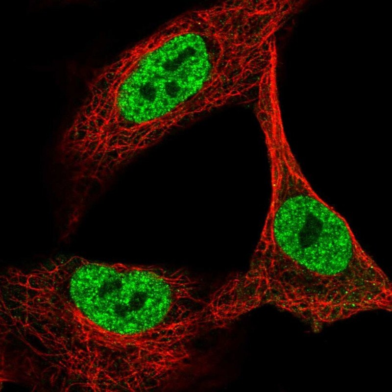 OGFOD2 Antibody - BSA Free Immunocytochemistry/ Immunofluorescence: OGFOD2 Antibody [NBP1-82253]