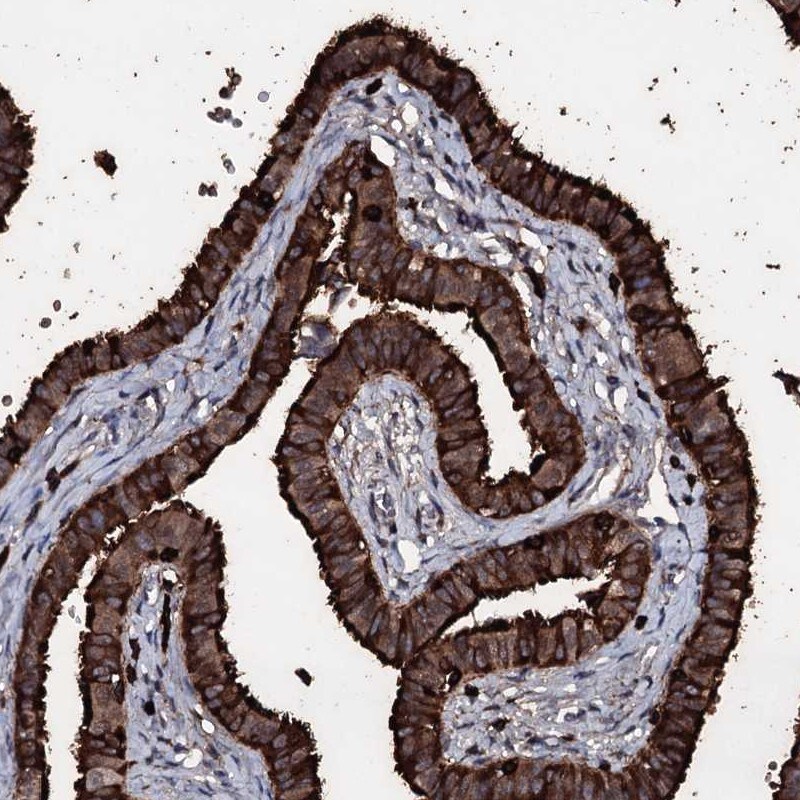 OGFOD2 Antibody - BSA Free Immunohistochemistry-Paraffin: OGFOD2 Antibody [NBP1-82254]