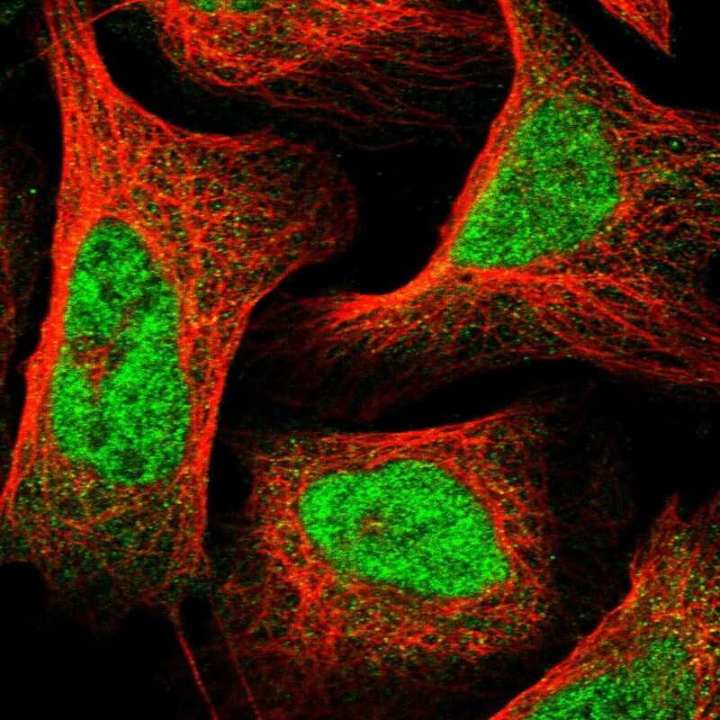 SLC7A6OS Antibody - BSA Free Immunocytochemistry/ Immunofluorescence: SLC7A6OS Antibody [NBP1-82260]