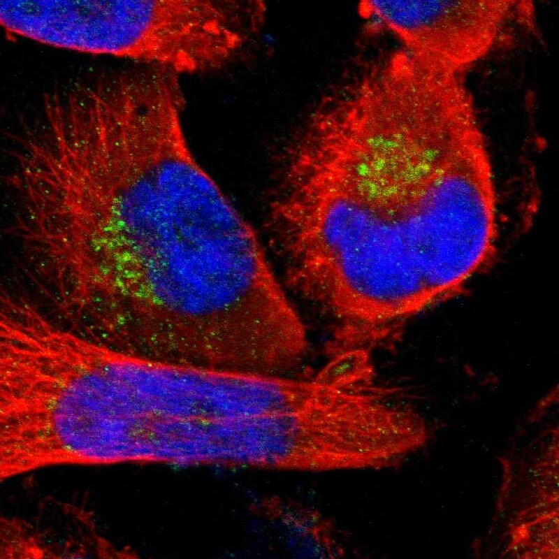MANEA Antibody - BSA Free Immunocytochemistry/ Immunofluorescence: MANEA Antibody [NBP1-82279]