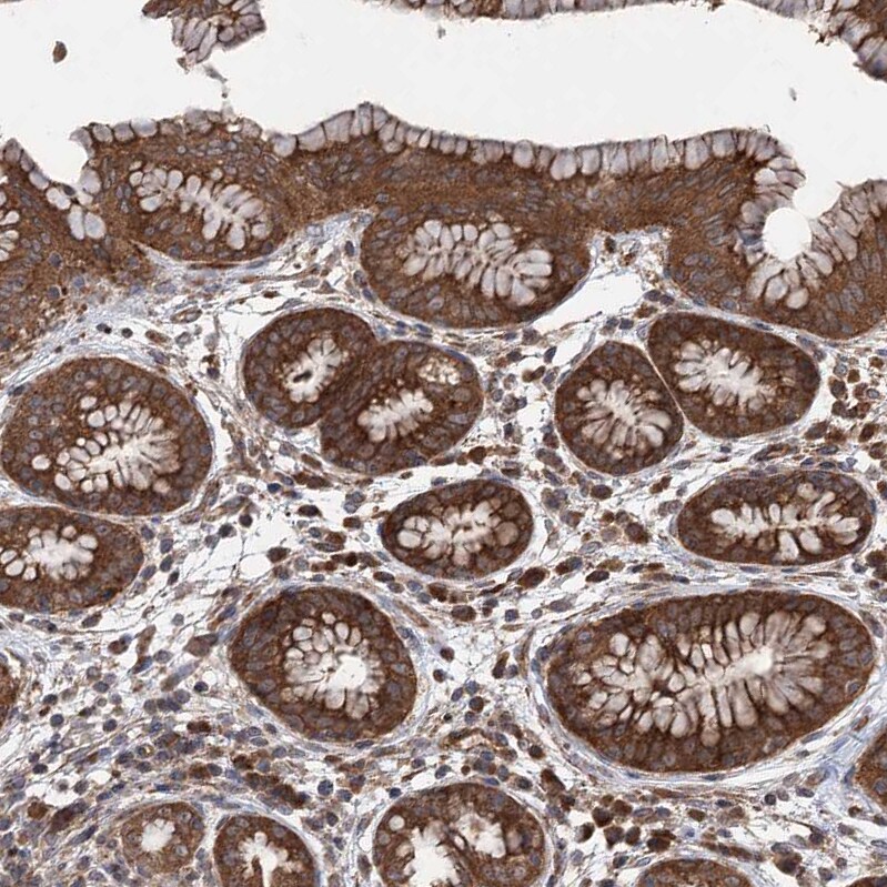 VPS37B Antibody - BSA Free Immunohistochemistry-Paraffin: VPS37B Antibody [NBP1-82283]