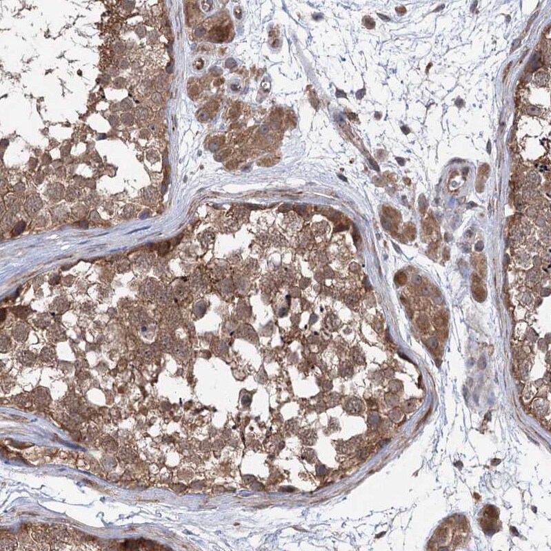 VPS37B Antibody - BSA Free Immunohistochemistry-Paraffin: VPS37B Antibody [NBP1-82283]