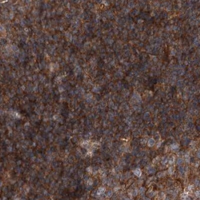 VPS37B Antibody - BSA Free Immunohistochemistry-Paraffin: VPS37B Antibody [NBP1-82283]