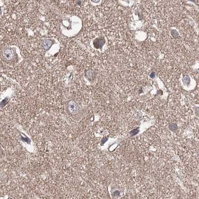 VPS37B Antibody - BSA Free Immunohistochemistry-Paraffin: VPS37B Antibody [NBP1-82283]