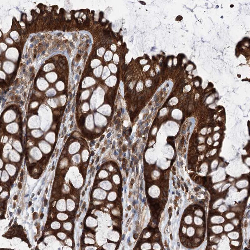 VPS37B Antibody - BSA Free Immunohistochemistry-Paraffin: VPS37B Antibody [NBP1-82283]