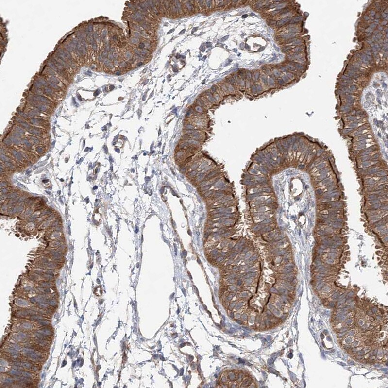 VPS37B Antibody - BSA Free Immunohistochemistry-Paraffin: VPS37B Antibody [NBP1-82283]