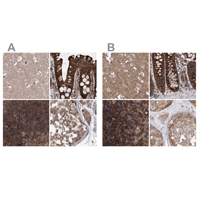VPS37B Antibody - BSA Free Immunohistochemistry-Paraffin: VPS37B Antibody [NBP1-82283]