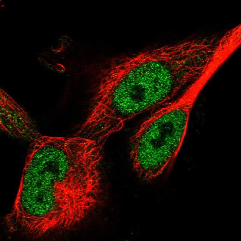 WDR75 Antibody - BSA Free Immunocytochemistry/ Immunofluorescence: WDR75 Antibody [NBP1-82296]