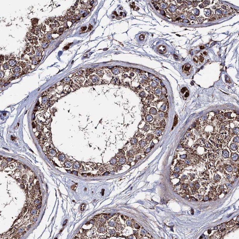 IQCH Antibody - BSA Free Immunohistochemistry-Paraffin: IQCH Antibody [NBP1-82300]