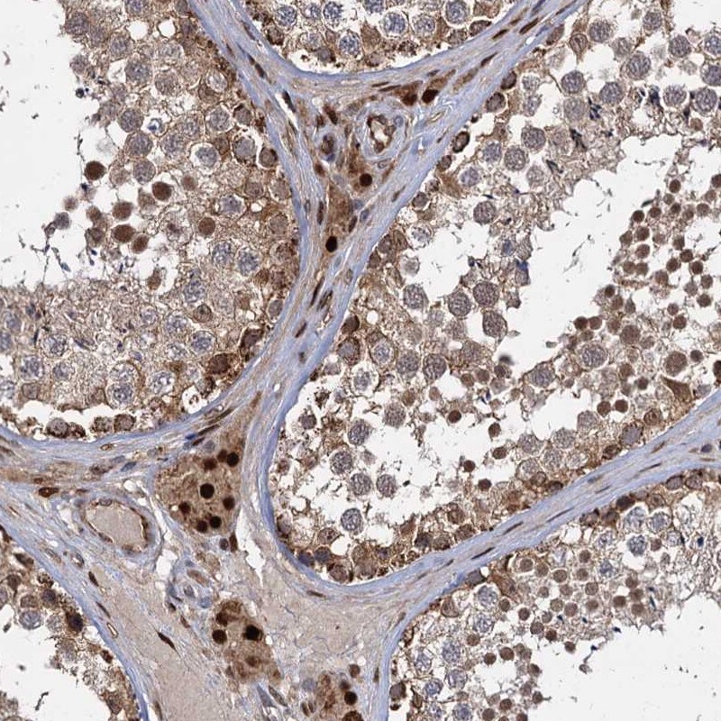 GAL3ST4 Antibody - BSA Free Immunohistochemistry-Paraffin: GAL3ST4 Antibody [NBP1-82309]