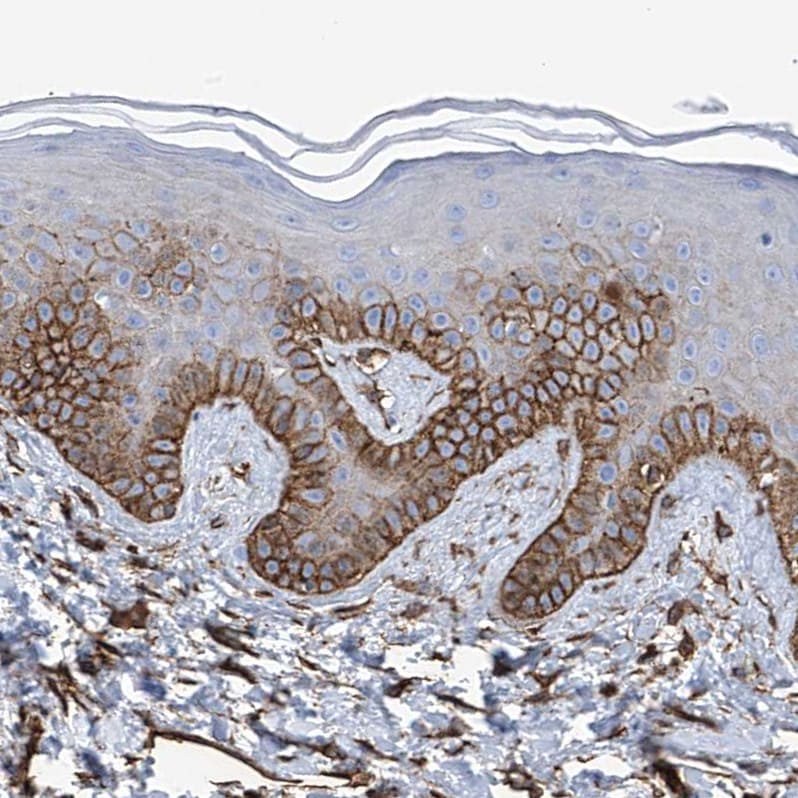 UBTD1 Antibody - BSA Free Immunohistochemistry-Paraffin: UBTD1 Antibody [NBP1-82311]