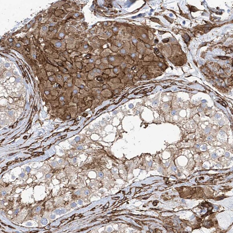 UBTD1 Antibody - BSA Free Immunohistochemistry-Paraffin: UBTD1 Antibody [NBP1-82311]