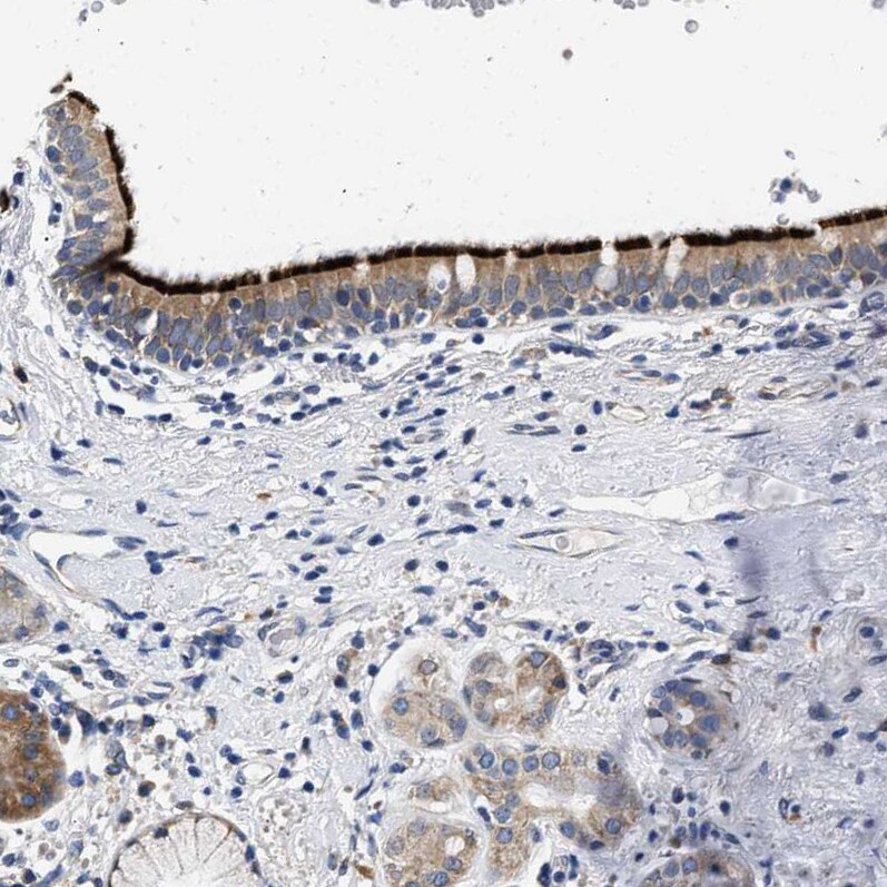 RINT1 Antibody - BSA Free Immunohistochemistry-Paraffin: RINT1 Antibody [NBP1-82312]