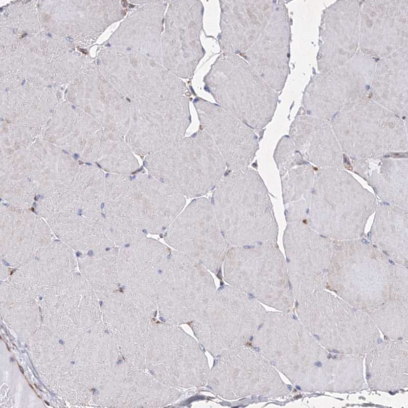 SNX18 Antibody - BSA Free Immunohistochemistry-Paraffin: SNX18 Antibody [NBP1-82361]