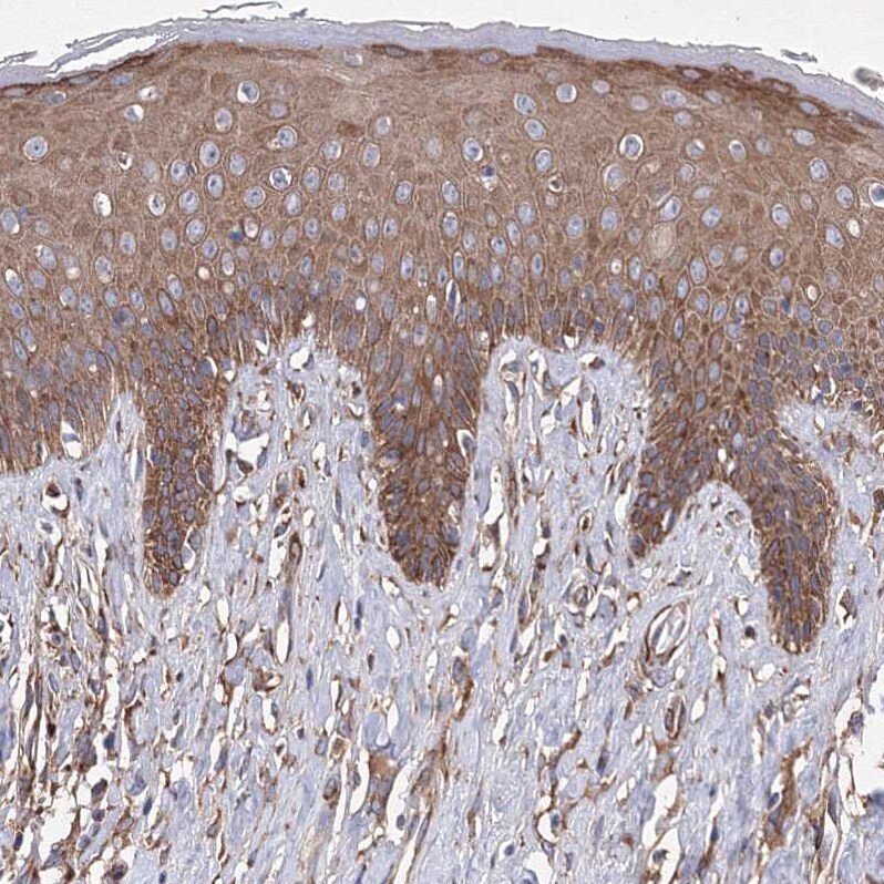 SNX18 Antibody - BSA Free Immunohistochemistry-Paraffin: SNX18 Antibody [NBP1-82361]