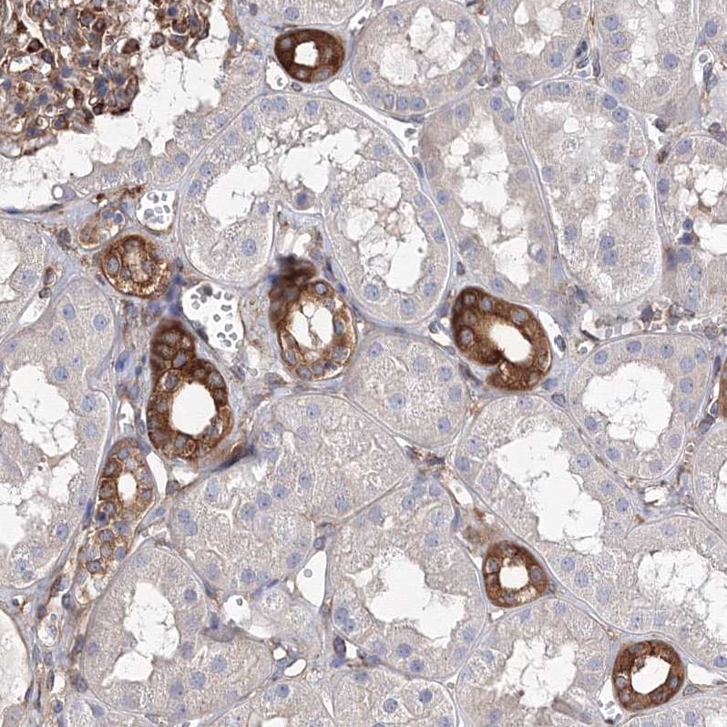 SNX18 Antibody - BSA Free Immunohistochemistry-Paraffin: SNX18 Antibody [NBP1-82361]