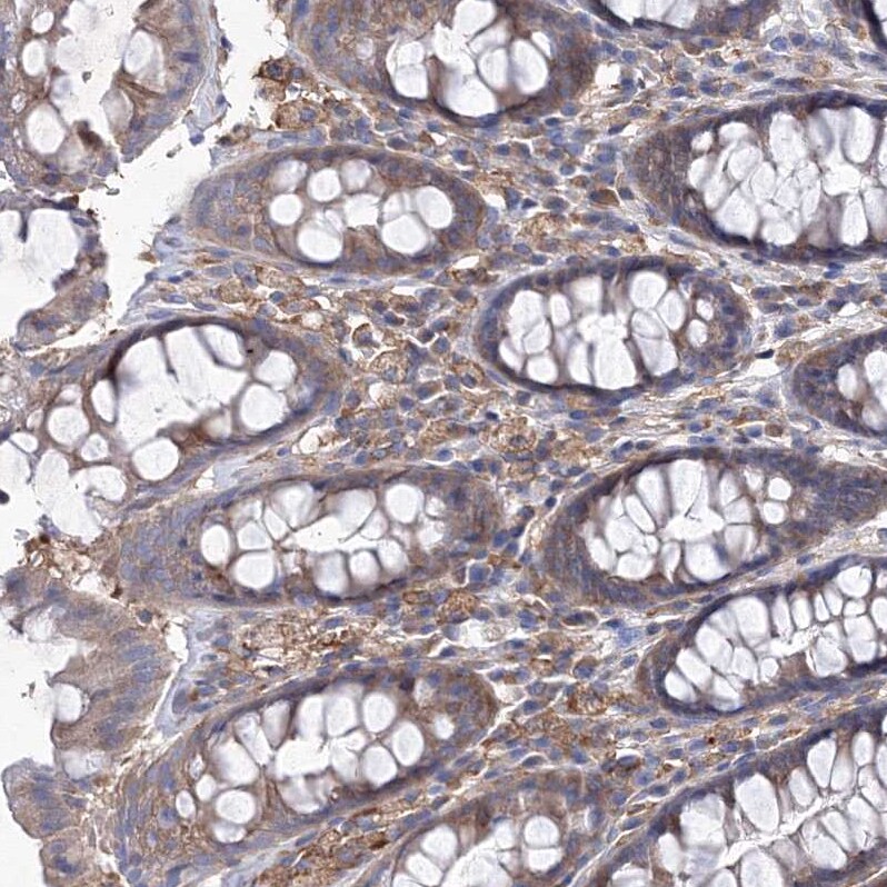 SNX18 Antibody - BSA Free Immunohistochemistry-Paraffin: SNX18 Antibody [NBP1-82361]