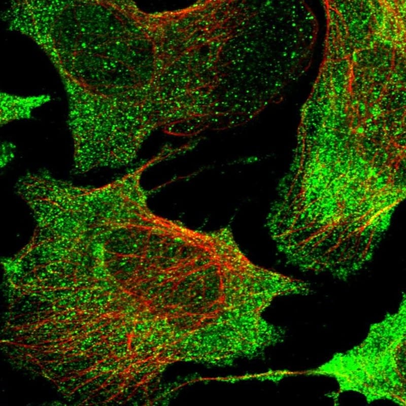 GPR63 Antibody - BSA Free Immunocytochemistry/ Immunofluorescence: GPR63 Antibody [NBP1-82362]