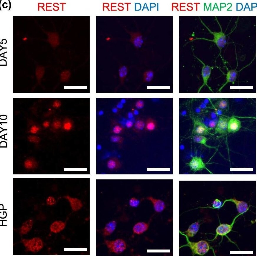 NRSF Antibody - BSA Free