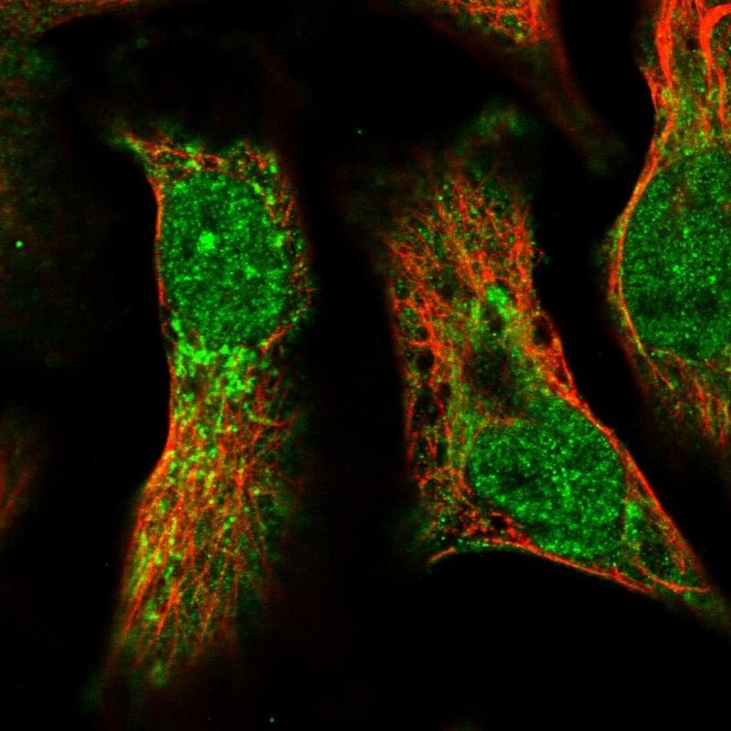 Pyruvate Dehydrogenase Phosphatase/PDP1/PPM2C Antibody - BSA Free Immunocytochemistry/ Immunofluorescence: Pyruvate Dehydrogenase Phosphatase/PDP1/PPM2C Antibody [NBP1-82432]