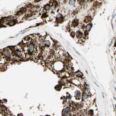 ME2 Antibody - BSA Free Immunohistochemistry-Paraffin: ME2 Antibody [NBP1-82434]