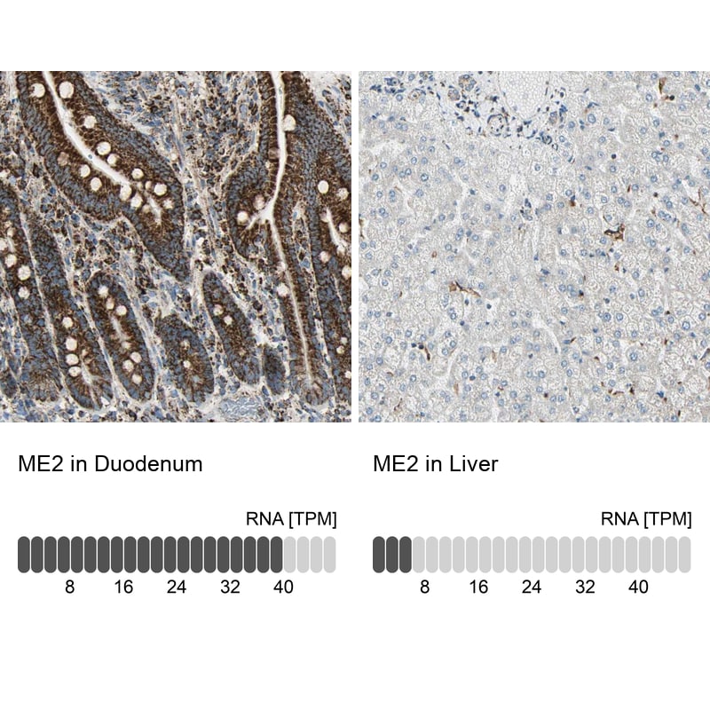 ME2 Antibody - BSA Free Immunohistochemistry-Paraffin: ME2 Antibody [NBP1-82434]