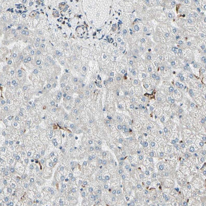 ME2 Antibody - BSA Free Immunohistochemistry-Paraffin: ME2 Antibody [NBP1-82434]