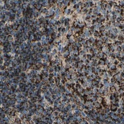 ME2 Antibody - BSA Free Immunohistochemistry-Paraffin: ME2 Antibody [NBP1-82434]