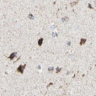 ME2 Antibody - BSA Free Immunohistochemistry-Paraffin: ME2 Antibody [NBP1-82434]