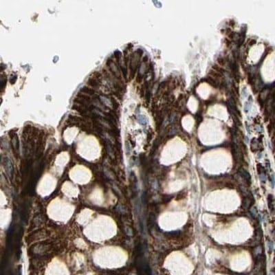 ME2 Antibody - BSA Free Immunohistochemistry-Paraffin: ME2 Antibody [NBP1-82434]