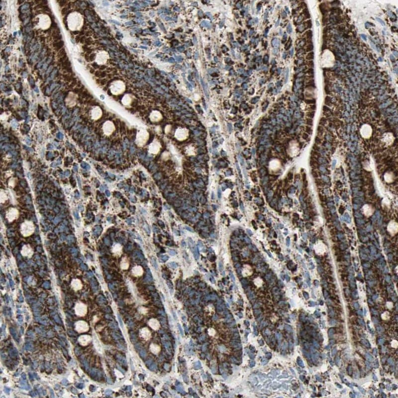 ME2 Antibody - BSA Free Immunohistochemistry-Paraffin: ME2 Antibody [NBP1-82434]