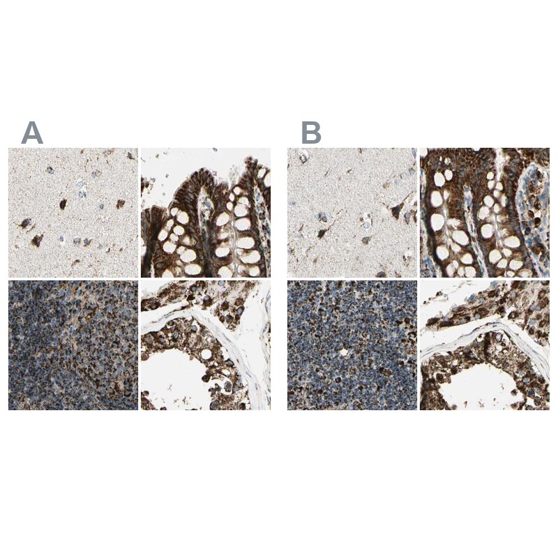 ME2 Antibody - BSA Free Immunohistochemistry-Paraffin: ME2 Antibody [NBP1-82434]