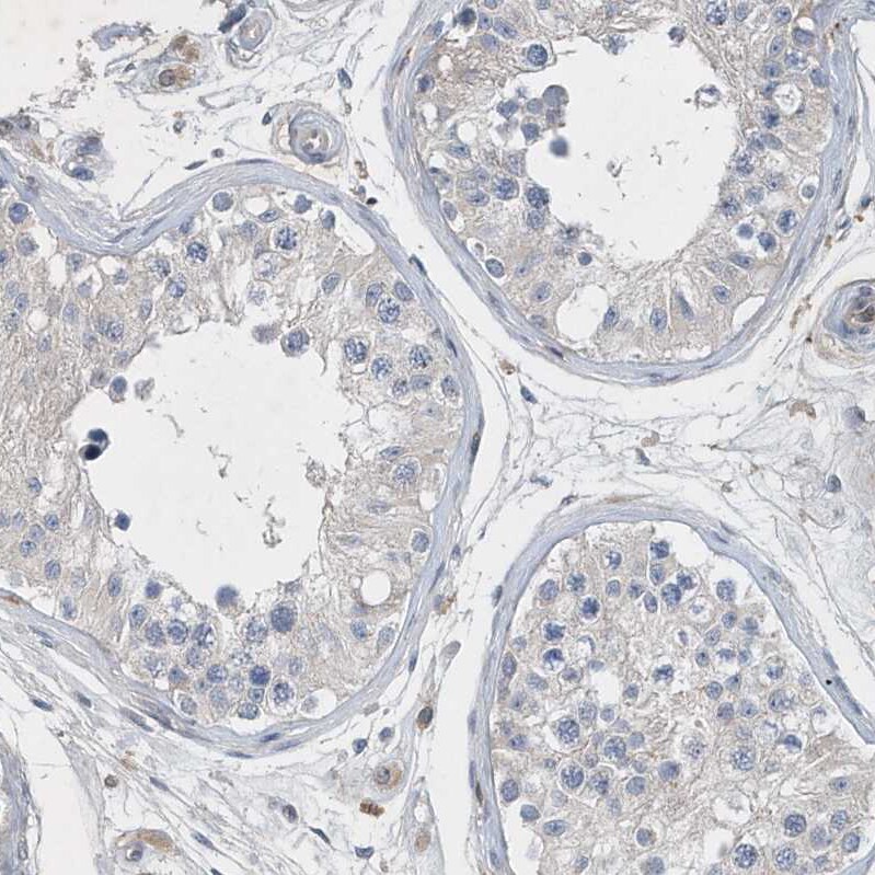 P2Y10/P2RY10 Antibody - BSA Free Immunohistochemistry-Paraffin: P2Y10/P2RY10 Antibody [NBP1-82438]