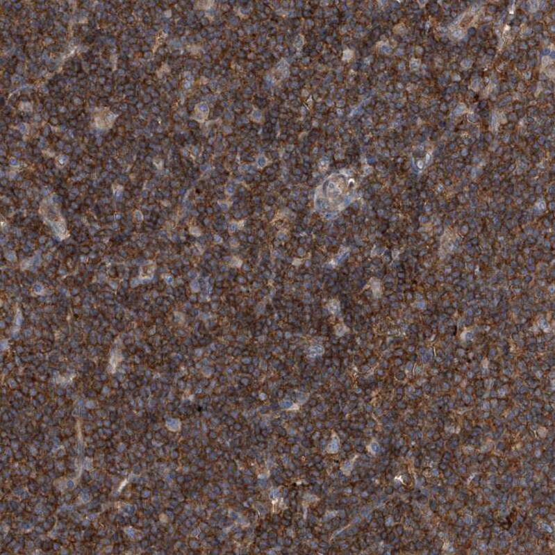 P2Y10/P2RY10 Antibody - BSA Free Immunohistochemistry-Paraffin: P2Y10/P2RY10 Antibody [NBP1-82438]