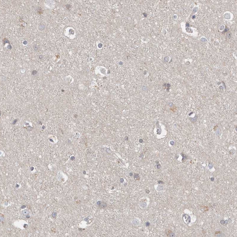 P2Y10/P2RY10 Antibody - BSA Free Immunohistochemistry-Paraffin: P2Y10/P2RY10 Antibody [NBP1-82438]