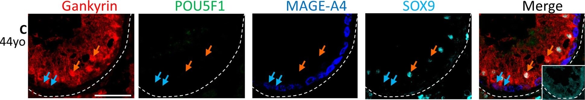 Gankyrin Antibody
