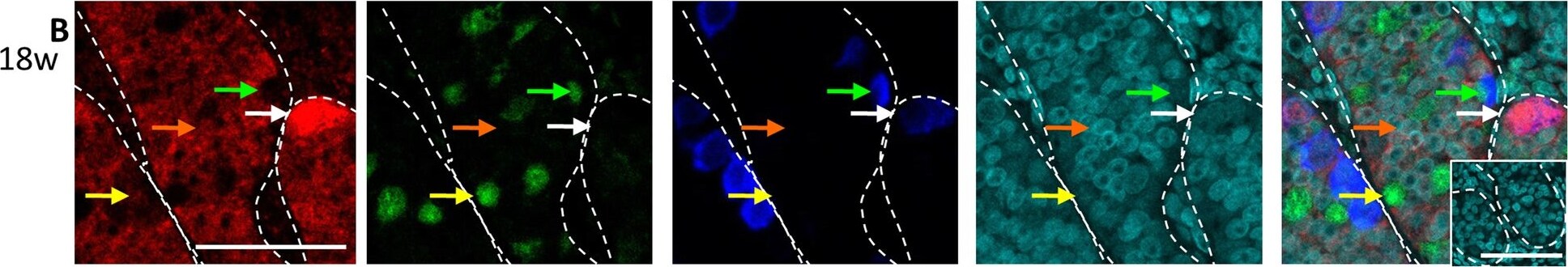 Gankyrin Antibody