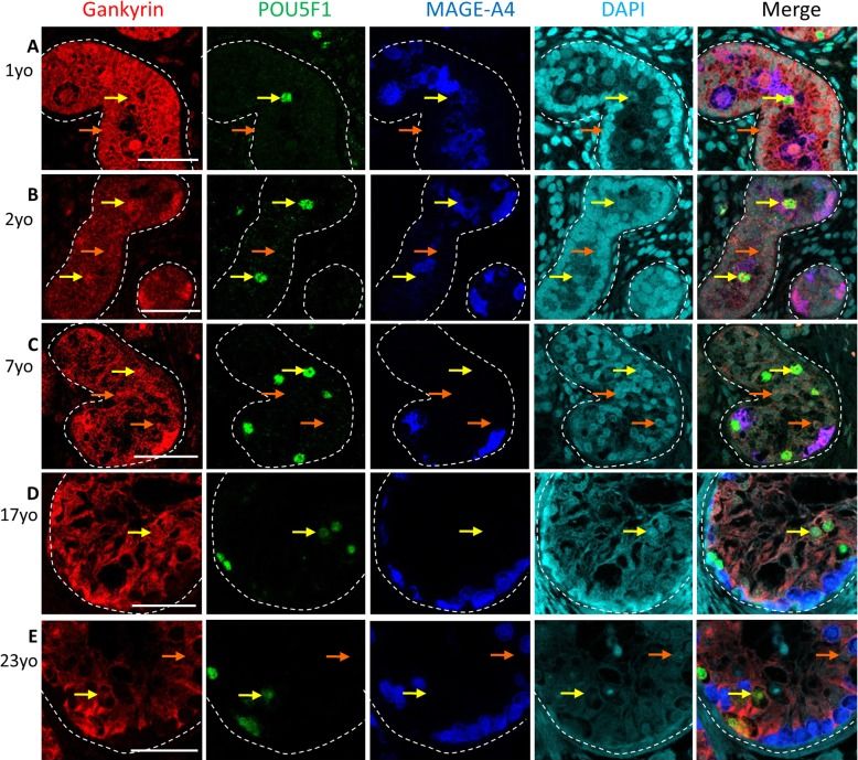 Gankyrin Antibody