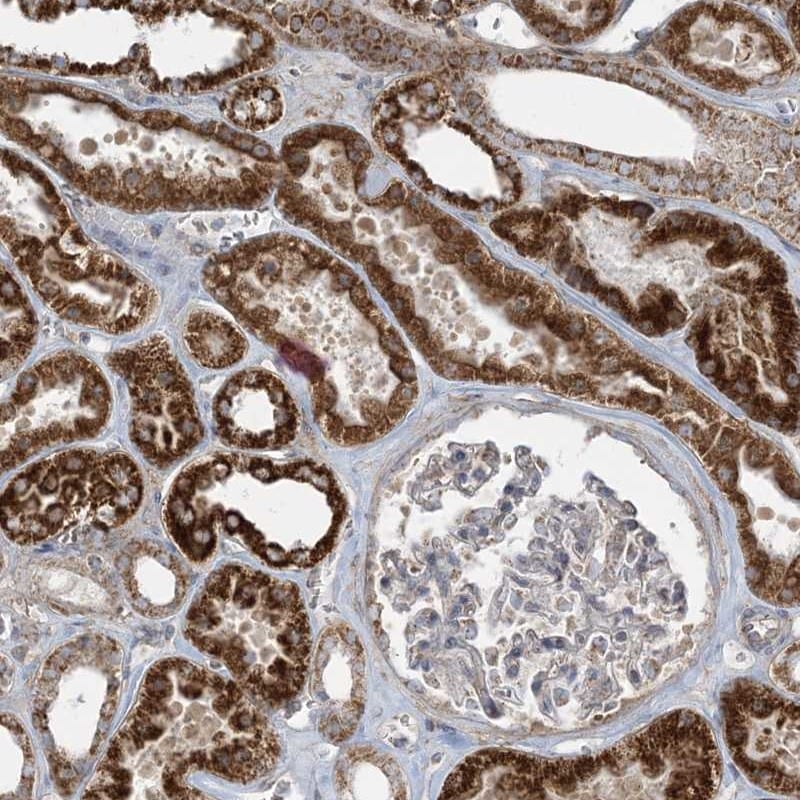 PIK3R4 Antibody - BSA Free Immunohistochemistry-Paraffin: PIK3R4 Antibody [NBP1-82451]